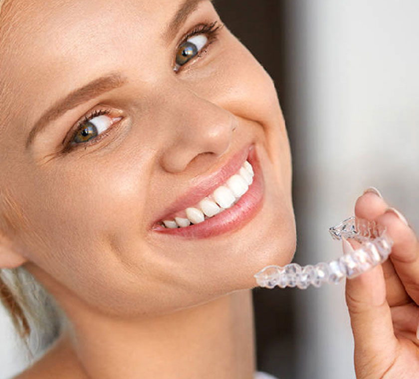 img-newsmile-treatment-benifits-invisalign