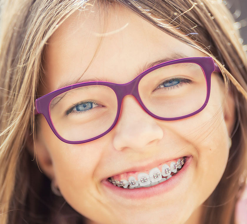 img-newsmile-treatment-benifits-traditionalbracesbenifits